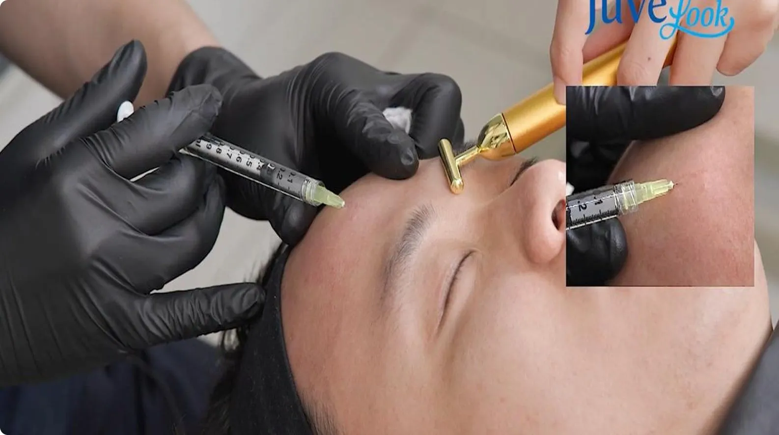 Juvelook®: Natural Rejuvenation for Eyes, Neck &amp; Full Face content post image