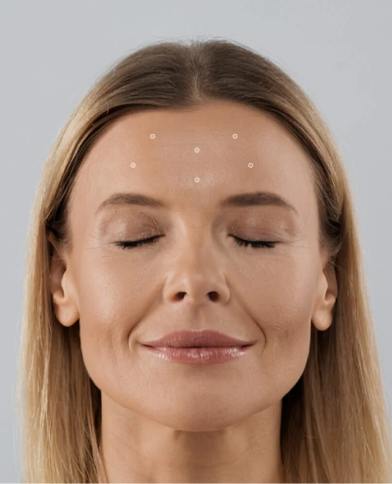 Relfydess mob Relfydess - rtwskin clinic