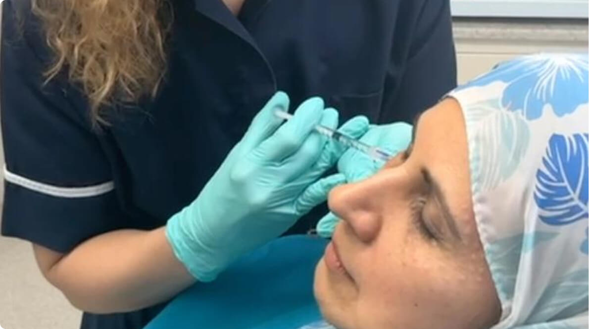 Key Benefits of NCTF 135HA for Under-Eye Rejuvenation