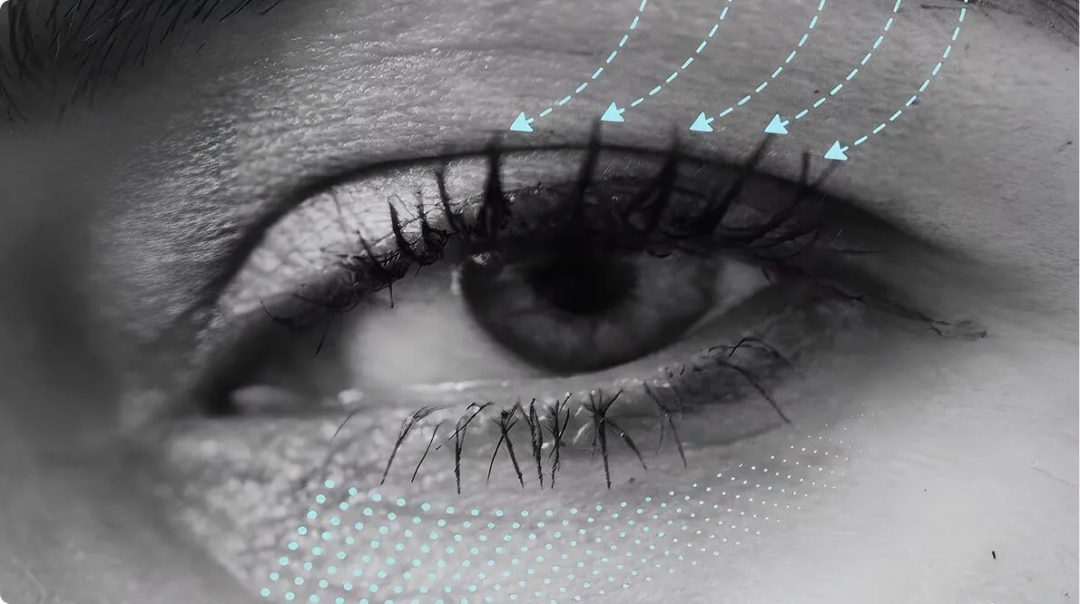 NCTF 135HA for Dark Circles and Periorbital Pigmentation