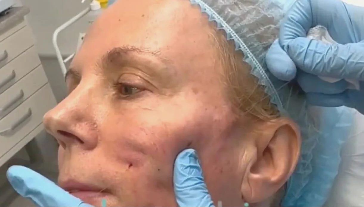 How Does Silhouette Soft Work?