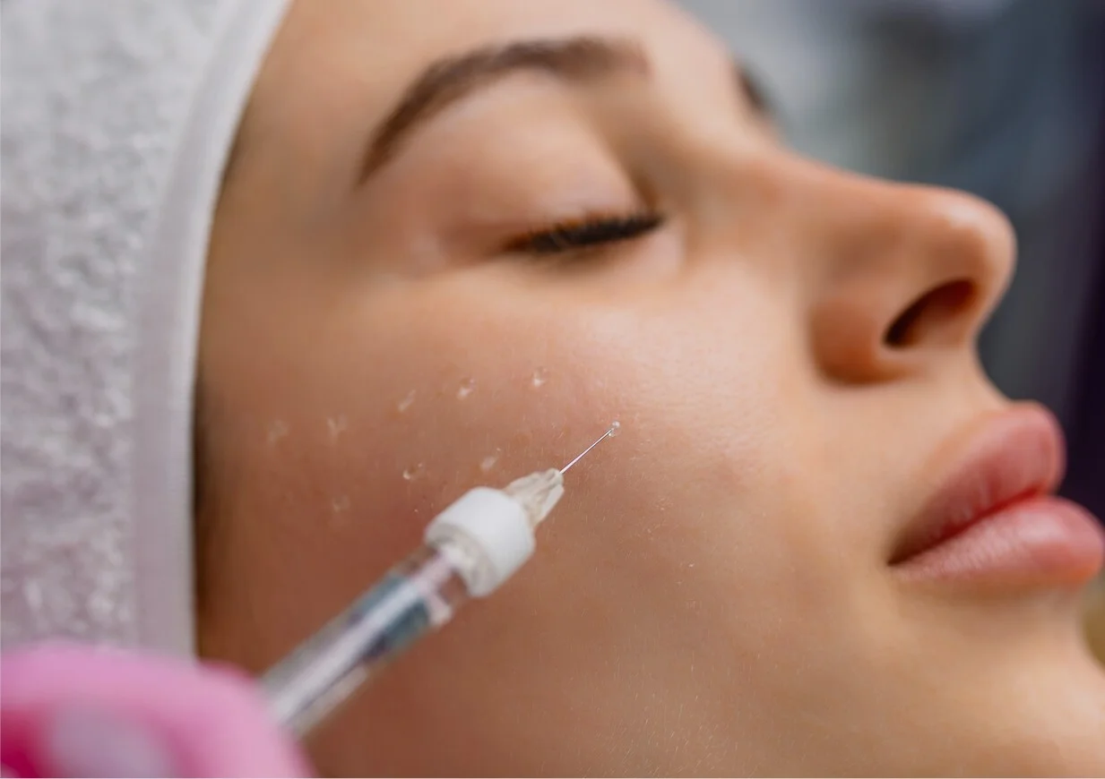 PRX-T33 with Microneedling