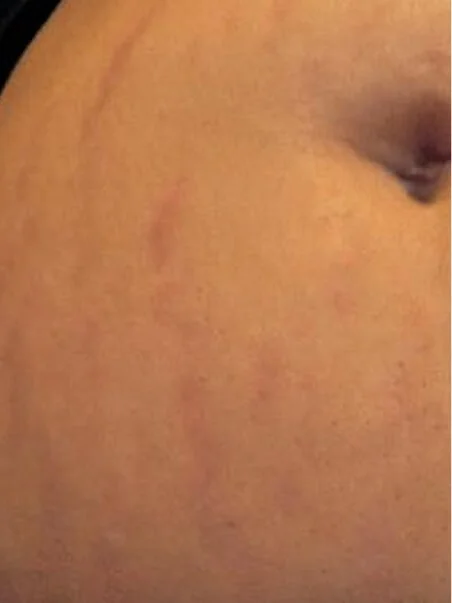 PRX-T33 Before and After Results
 after result